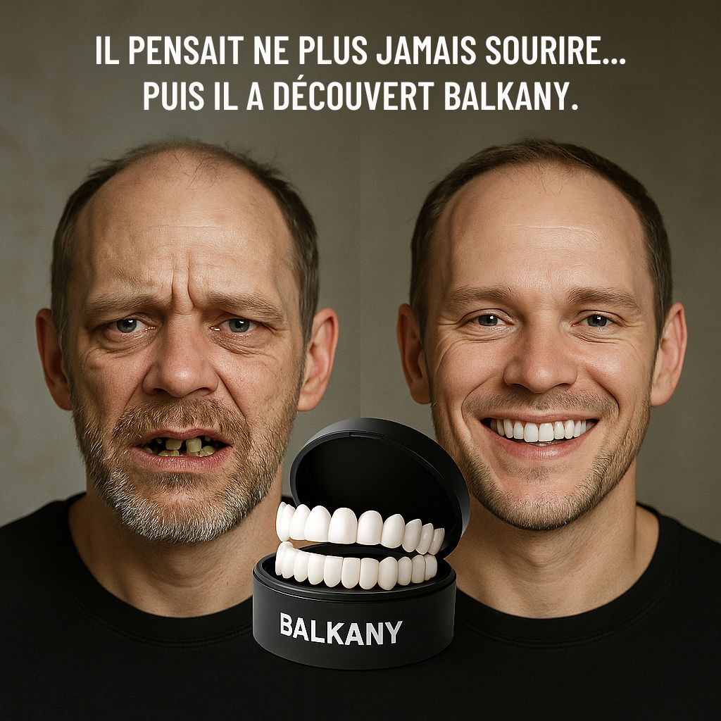Facettes ajustables à clipser