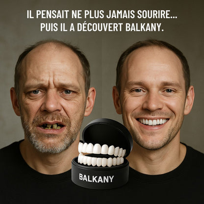 Facettes ajustables à clipser